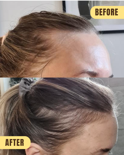 GROWSMARY - for thinning, sparse hair